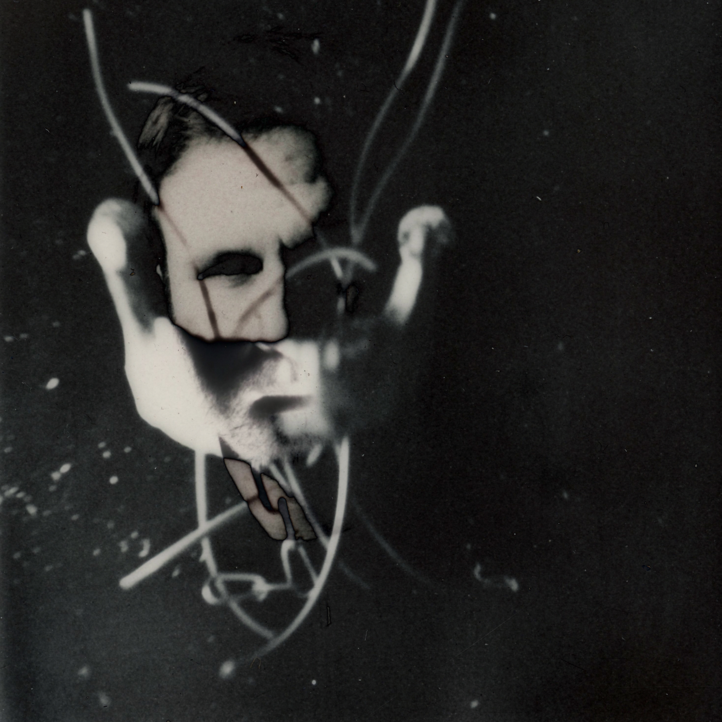 Human, Jaw and Wires